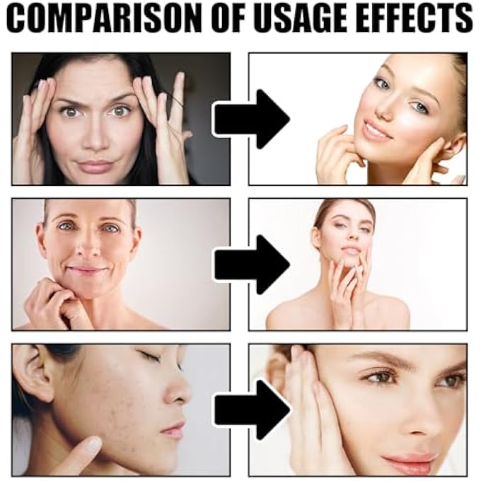 STRBOXONG مجموعة العناية بالوجه بدم التنين، كريم دم التنين السهل و Essence مضاد التجاعيد، مرطب ومغذي، يشد البشرة، مناسب لجميع أنواع البشرة - Image 3